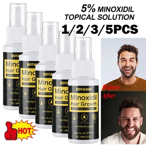 60ml minoxidil bart - 5%,